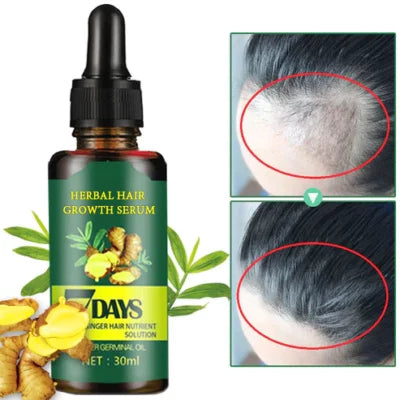 VitiLock™ 7 Days Herbal Hair Growth Serum