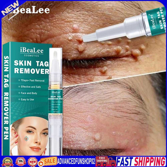 5ml Skin Tag Remover Pen Natural Ingredients Mole Remover Pens for Beauty Health