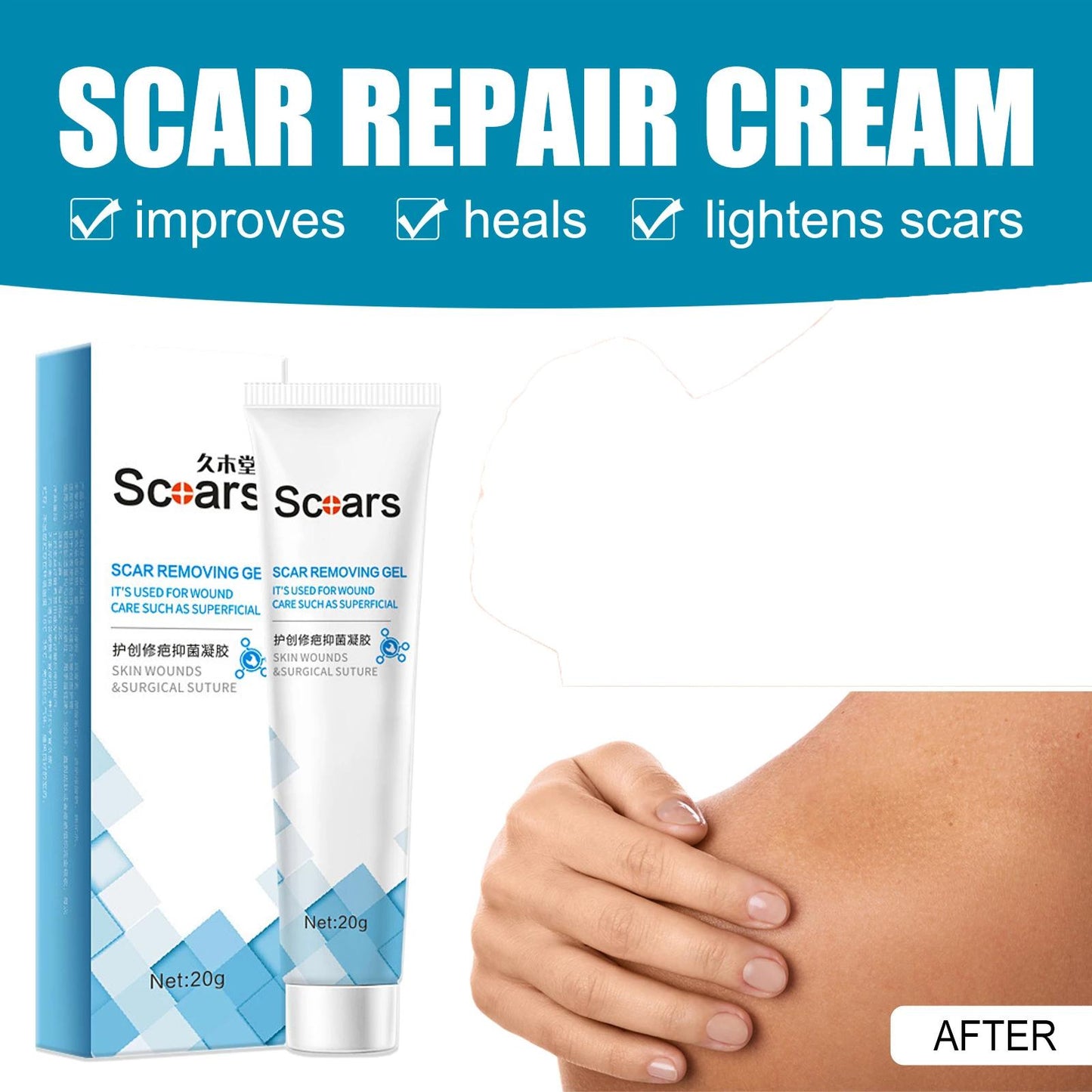 Acne Scar Removal Cream Gel Stretch Marks Remove Acne Spots Burn Surgical Scars Treatment Smooth Whitening Face Skin Care Cream