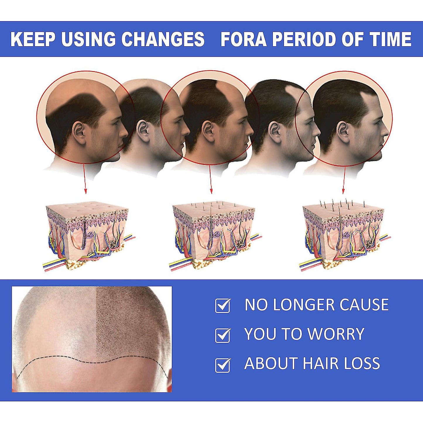 Ginger Hair Grower Spray Anti Hair Fall Hair Loss Treatment Hair Growth Essence Oil For Men