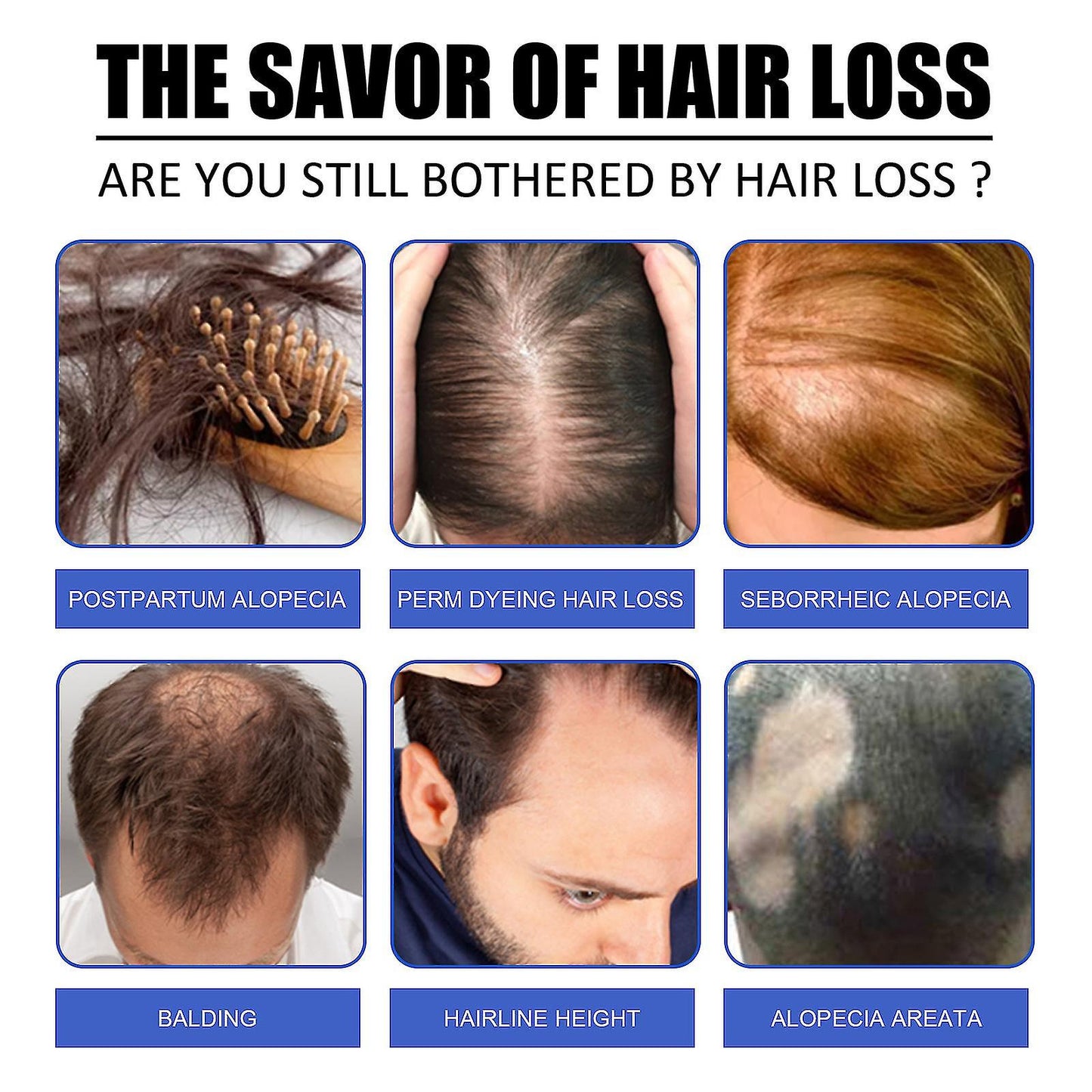 Spray Anti-chute de cheveux Traitement de perte de cheveux Huile d'essence de croissance de cheveux pour hommes