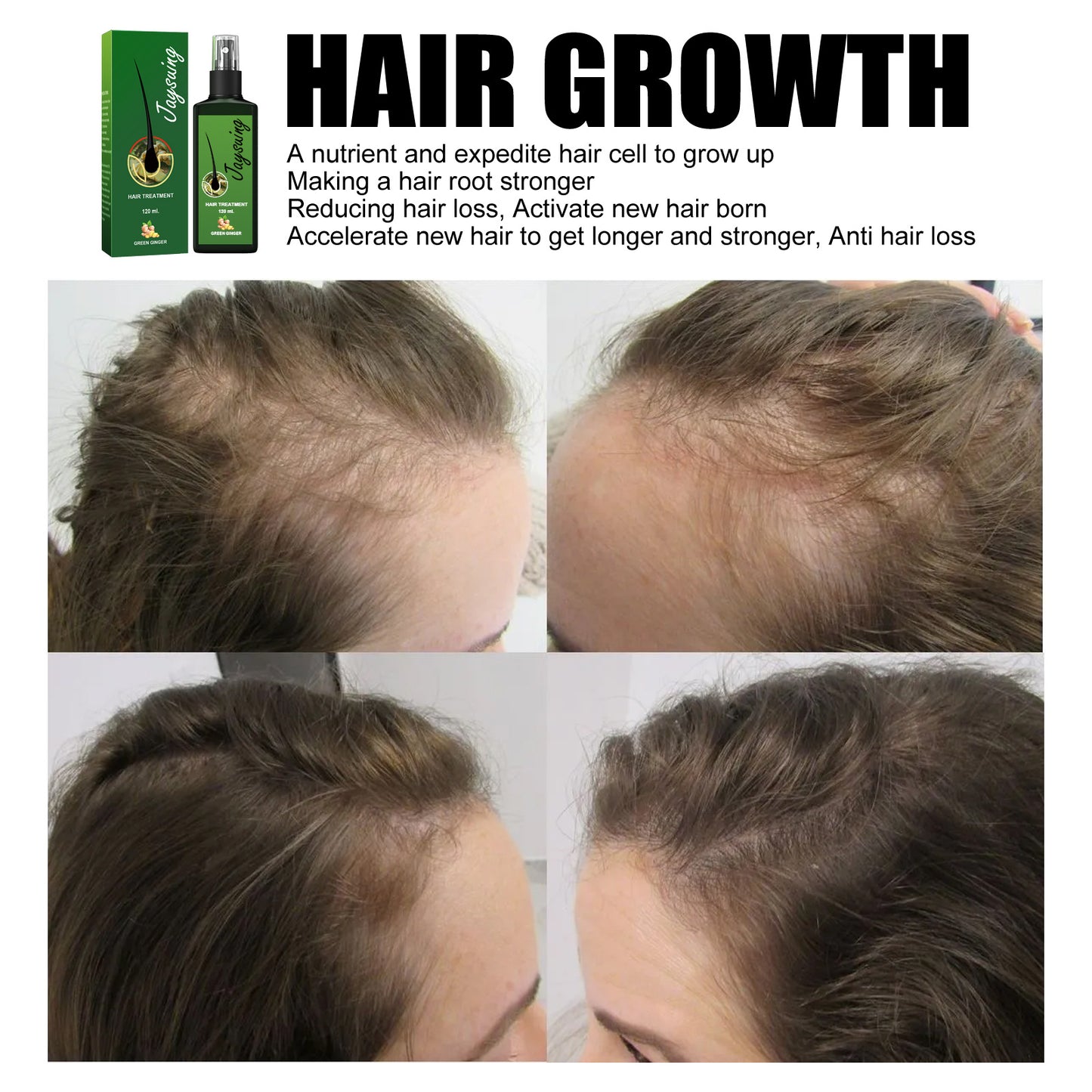 Original JaySuing Neo Hair Regrowth Lotion 120 ML Original JaySuing Neo لوشن إعادة نمو الشعر 120 مل