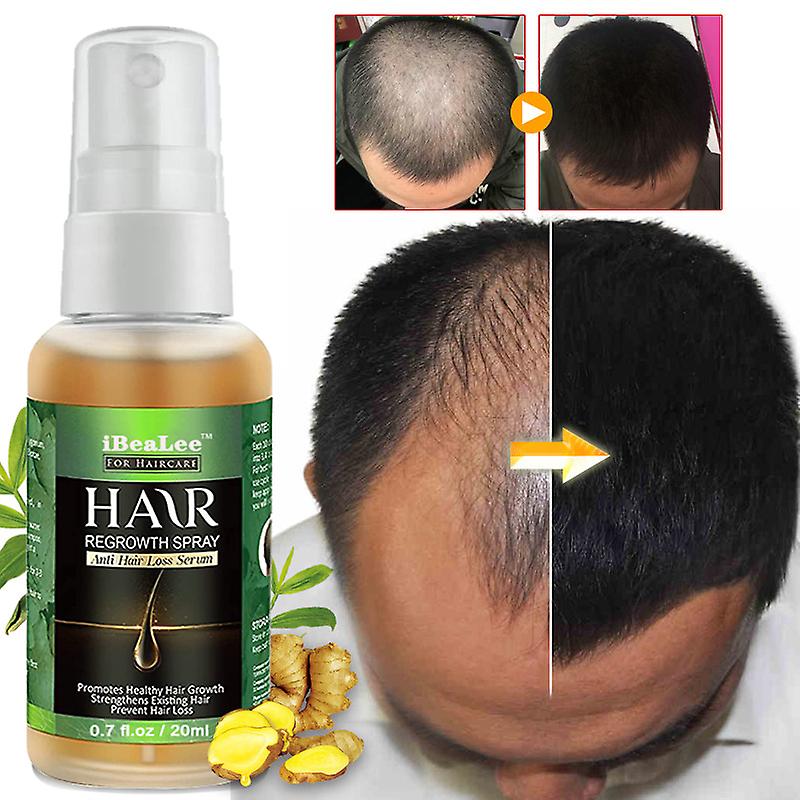 Hair Care Hair Growth Essential Oils Essence Hair Loss Liquid Health Care Beauty Dense Hair