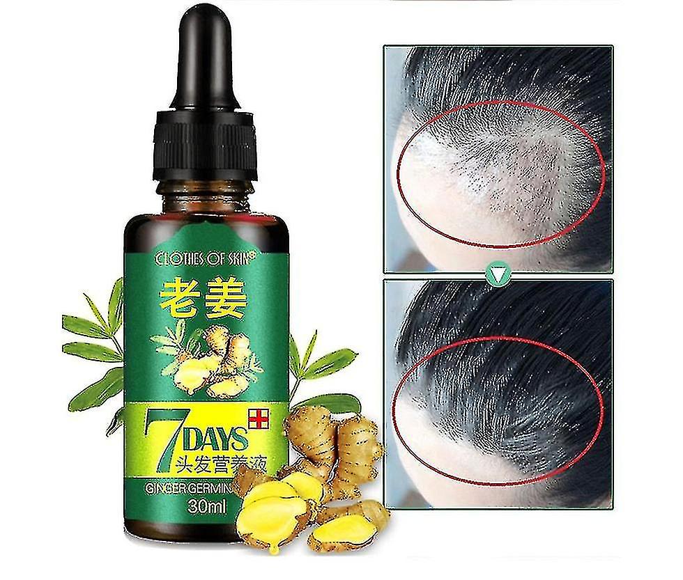 1 pièces/2 pièces/3 pièces huile germinale de gingembre Solution nutritive pour les cheveux Essence de croissance des cheveux liquide cheveux rapides