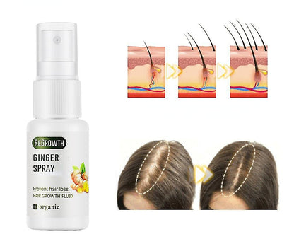 20 ml Gingembre Spray Repousse Gingembre Spray Rapide Croissance Des Cheveux Fluide Anti Perte Traitement Gingembre