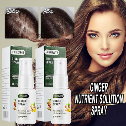 20ml Ginger Spray Regrowth Ginger Spray Fast Hair Growth Fluid Anti Loss Treatment Ginger