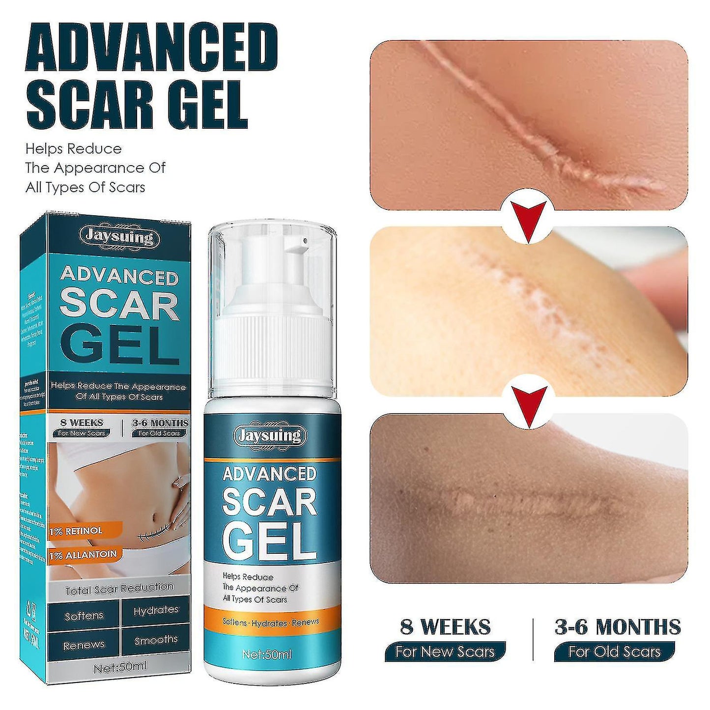 Scar Cream Gel 50ml - Silicone Scar Gel Scar Therapy For Surgical Scars, For Face, Scar Gel