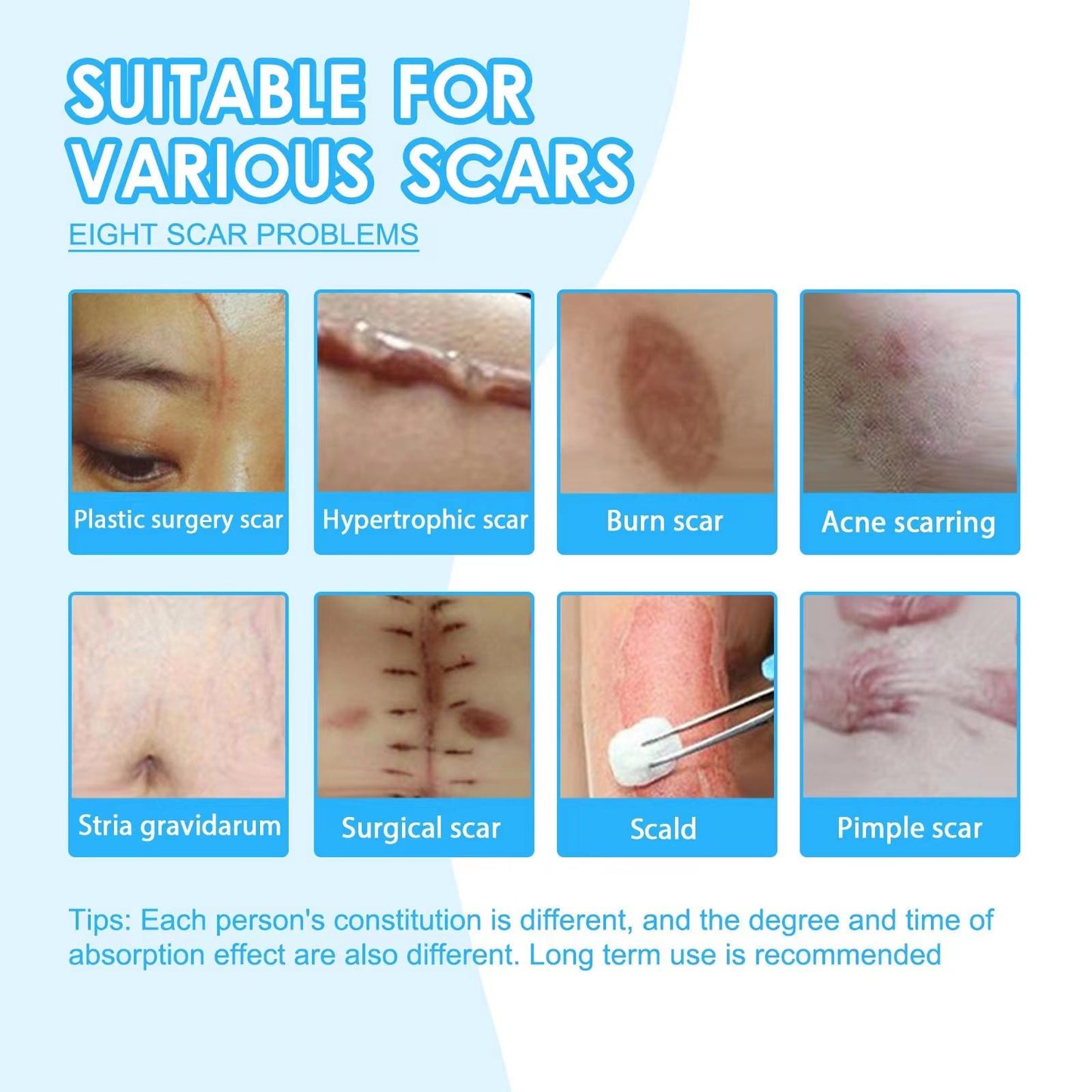 Scar Removal Cream Repair Gel For Acne Spots Dent Face Body Burn Scar Smooth Repair Cream Skin Care