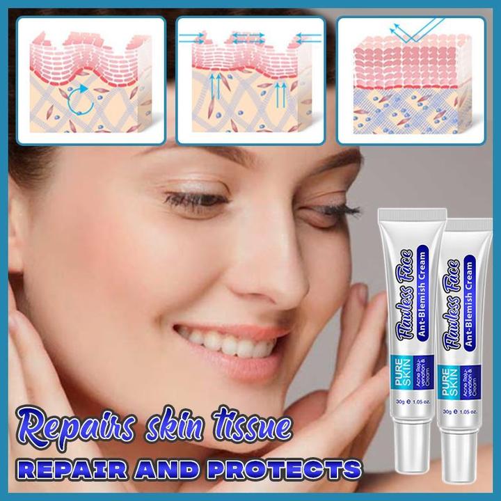 Perfect Skin Anti-Blemish Cream