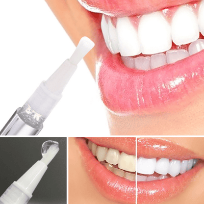 Teeth Whitening Pen