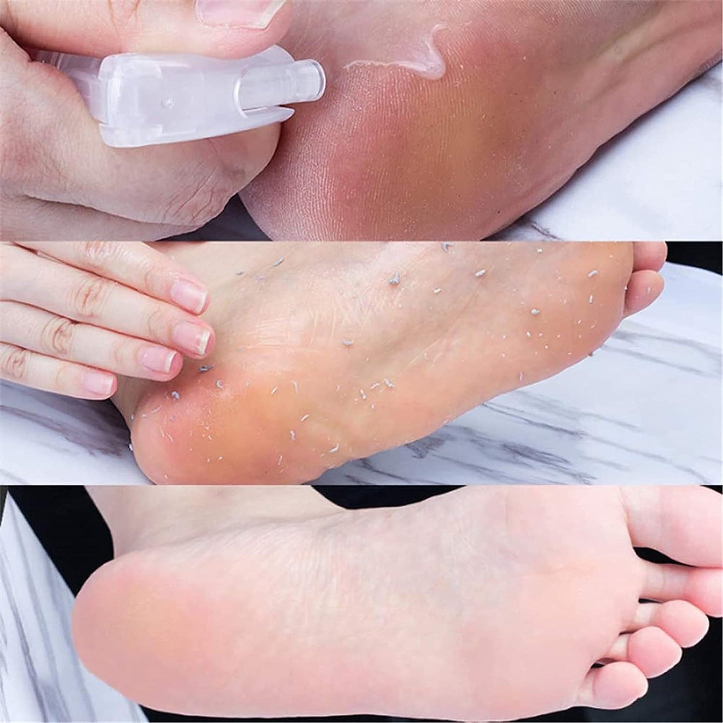 Gokame Foot Peeling Spray Orange Oil, Foot Peeling Spray That Remove Dead Skin, Hydrating Nourish Peel Off Spray, Remove Dead Skin within Seconds, Exfoliating Peeling & Calluses on Feet, 110ML
