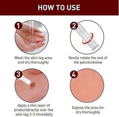 Wipe Off Tags And Mole Remover, Skin Tag Remover Liquid, Effectively Remove Skin Tags -3ml