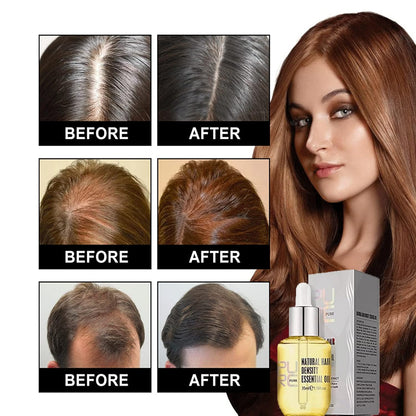 Purc Oil for Hair Growth,Natural Hair Density Essential Oil，Purc Hair Growth Essence Oil,Purc Hair Treatment for Women & Men