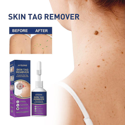 Skin Tag Remover Super Strong Skin Tag Remover Serum Made From Natural Plant Extracts For Face
