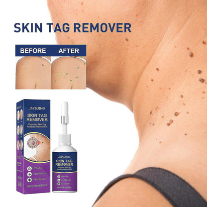 Skin Tag Remover Super Strong Skin Tag Remover Serum Made From Natural Plant Extracts For Face