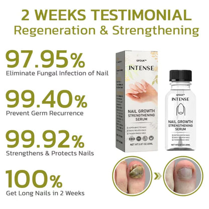 GFOUK™️ Intense Nail Growth and Strengthening Serum