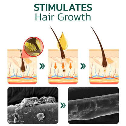 HairVive™ Scalp Folliculitis Therapy Oil
