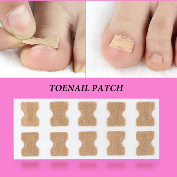Toecure – Glue-Free Toenail Correction Patch