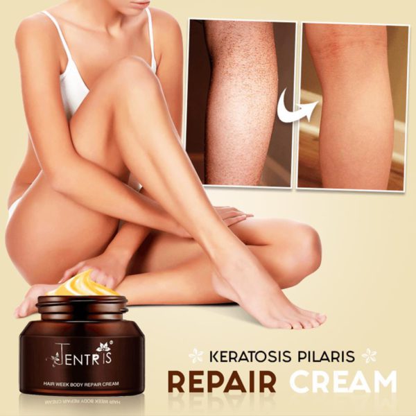 Keratosis Pilaris Repair Cream