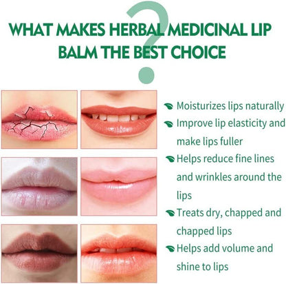 GFOUK Blistfix Herbal Medicated Lip Balm for Dry Cracked Lips