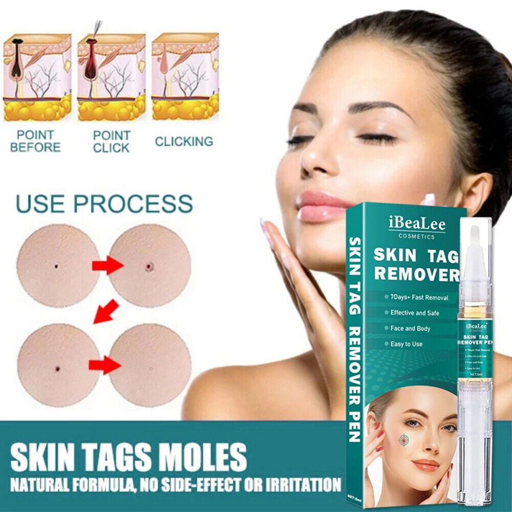 5ml Skin Tag Remover Pen Natural Ingredients Mole Remover Pens for Beauty Health