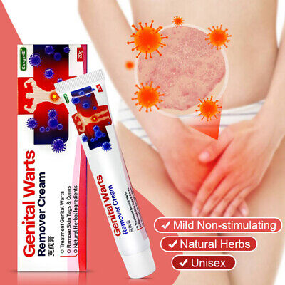 Genital Herpes Wart Remover Ointment Skin Tag Mole Acuminatum Treatment Cream